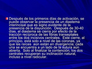 Después de los primeros días de activación, se puede observar la presencia de un diastema interincisal que es signo evidente de la presencia de la disyunción.  Después de 30-40 días, el diastema se cierra por efecto de la tracción recíproca de las fibras transeptales entre los dos incisivos centrales.  Este cierre, al principio, está solo a nivel de las coronas, ya que las raíces  aún están en divergencia; cada una se encuentra a un lado de la sutura aún abierta.  Solo al finalizar la contención, los dos centrales recuperan su inclinación natural, incluso a nivel radicular. 