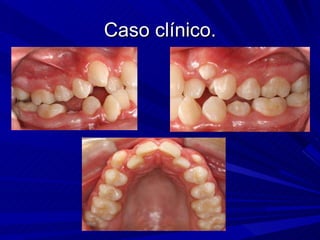 Caso clínico. 