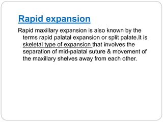 Expansion in orthodontics | PPTX