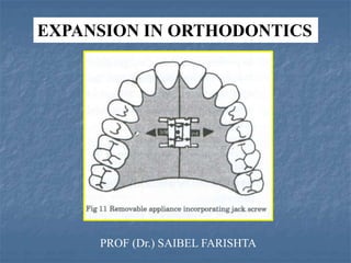 EXPANSION IN ORTHODONTICS
PROF (Dr.) SAIBEL FARISHTA
 