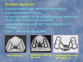 Expansion in orthodontics.pptxx final ppt | PPT