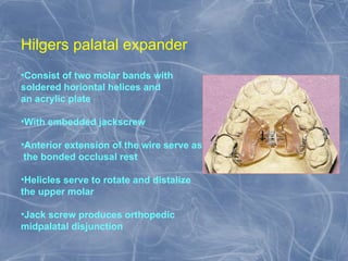 Expansion in orthodontics.pptxx final ppt | PPT
