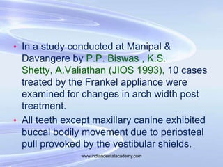 • In a study conducted at Manipal &
Davangere by P.P. Biswas , K.S.
Shetty, A.Valiathan (JIOS 1993), 10 cases
treated by t...