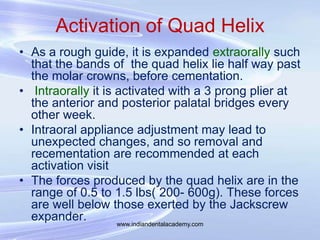 Activation of Quad Helix
• As a rough guide, it is expanded extraorally such
that the bands of the quad helix lie half way...