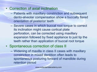 • Correction of axial inclination
– Patients with maxillary constriction and subsequent
dento-alveolar compensation show a...
