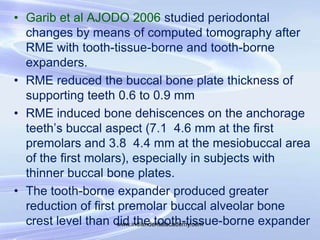 • Garib et al AJODO 2006 studied periodontal
changes by means of computed tomography after
RME with tooth-tissue-borne and...