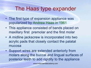 The Haas type expander
• The first type of expansion appliance was
popularized by Andrew Haas in 1961
• This appliance con...