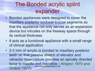 The Bonded acrylic splint
expander
• Bonded appliances were designed to cover the
maxillary posterior occlusal-buccal segm...