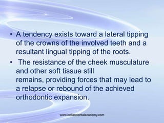 • A tendency exists toward a lateral tipping
of the crowns of the involved teeth and a
resultant lingual tipping of the ro...