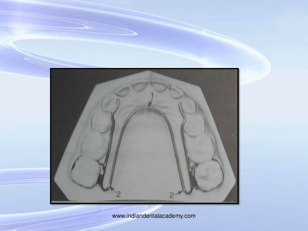 Expansion in orthodontics,/certified fixed orthodontic courses by Ind…