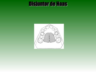 Disjuntor de Haas 
