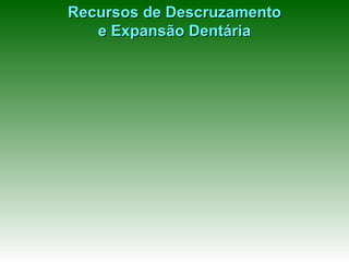 Recursos de Descruzamento e Expansão Dentária 