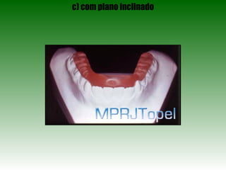 c) com plano inclinado 