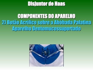 Disjuntor de Haas COMPONENTES DO APARELHO 2) Botão Acrílico sobre a Abóbada Palatina Aparelho Dentomucossuportado 