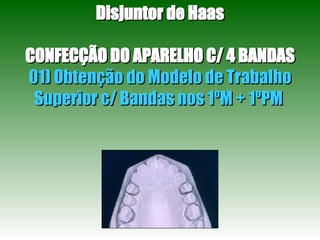 Disjuntor de Haas CONFECÇÃO DO APARELHO C/ 4 BANDAS 01) Obtenção do Modelo de Trabalho Superior c/ Bandas nos 1ºM + 1ºPM  