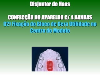 Disjuntor de Haas CONFECÇÃO DO APARELHO C/ 4 BANDAS 02) Fixação do Bloco de Cera Utilidade no Centro do Modelo 