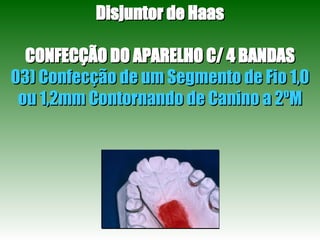 Disjuntor de Haas CONFECÇÃO DO APARELHO C/ 4 BANDAS 03) Confecção de um Segmento de Fio 1,0 ou 1,2mm Contornando de Canino a 2ºM 