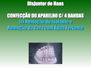 Disjuntor de Haas CONFECÇÃO DO APARELHO C/ 4 BANDAS 11) Remoção do Isolante e Remoção da Cera com Água Fervente 