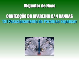 Disjuntor de Haas CONFECÇÃO DO APARELHO C/ 4 BANDAS 13) Posicionamento do Parafuso Expansor 