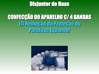 Disjuntor de Haas CONFECÇÃO DO APARELHO C/ 4 BANDAS 17) Remoção da Proteção do Parafuso Expansor 