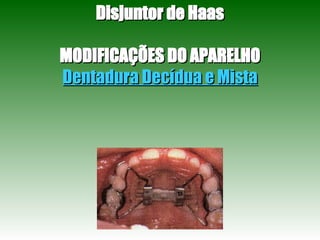 Disjuntor de Haas MODIFICAÇÕES DO APARELHO Dentadura Decídua e Mista 