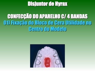Disjuntor de Hyrax CONFECÇÃO DO APARELHO C/ 4 BANDAS 01) Fixação do Bloco de Cera Utilidade no Centro do Modelo 
