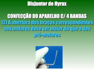 Disjuntor de Hyrax CONFECÇÃO DO APARELHO C/ 4 BANDAS 12) A abertura dos braços correspondentes aos molares deve ser maior do que a dos pré-molares 