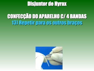 Disjuntor de Hyrax CONFECÇÃO DO APARELHO C/ 4 BANDAS 13) Repetir para os outros braços 