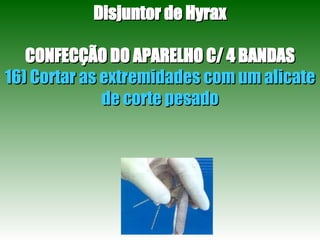 Disjuntor de Hyrax CONFECÇÃO DO APARELHO C/ 4 BANDAS 16) Cortar as extremidades com um alicate de corte pesado 