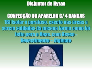 Disjuntor de Hyrax CONFECÇÃO DO APARELHO C/ 4 BANDAS 18) Isolar o parafuso, exceto nas áreas a serem soldadas da mesma forma como foi feito para o Haas, com Gesso - Revestimento – Alginato 