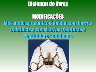 Disjuntor de Hyrax MODIFICAÇÕES Mas pode ser confeccionado com barras palatinas e com barras palatinas e vestibulares soldadas 