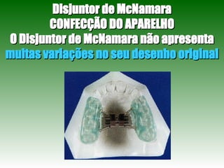 Disjuntor de McNamara CONFECÇÃO DO APARELHO O Disjuntor de McNamara não apresenta  muitas variações no seu desenho original 