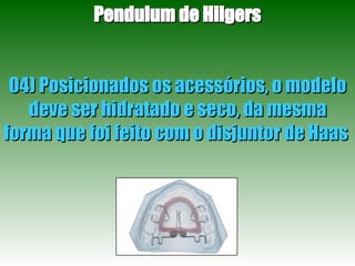 Pendulum de Hilgers 04) Posicionados os acessórios, o modelo deve ser hidratado e seco, da mesma forma que foi feito com o disjuntor de Haas  