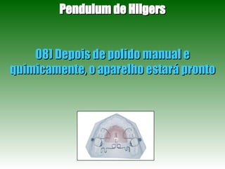 Pendulum de Hilgers 08) Depois de polido manual e quimicamente, o aparelho estará pronto 