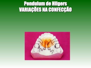 Pendulum de Hilgers VARIAÇÕES NA CONFECÇÃO 