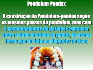 Pendulum-Pendex A construção do Pendulum-pendex segue os mesmos passos do pendulum, mas com  o posicionamento do parafuso expansor sobre a linha mediana do palato, da msma forma que foi feito no disjuntor de Haas 