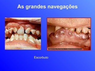 As grandes navegações Escorbuto 