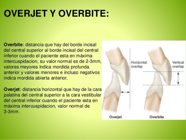El dolor a la marcha en los riñones y los pies que este tal