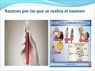 Razones por las que se realiza el examen
 