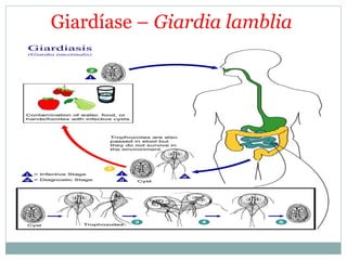 Giardíase – Giardia lamblia
 