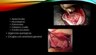 TIPOS DE CIRUGÍA
• Abdominales
• Neurológicas
• Pulmonares
• Cabeza y cuello
• Cardiovasculares
• Urgencias quirúrgicas
• Cirugías con anestesia general
 