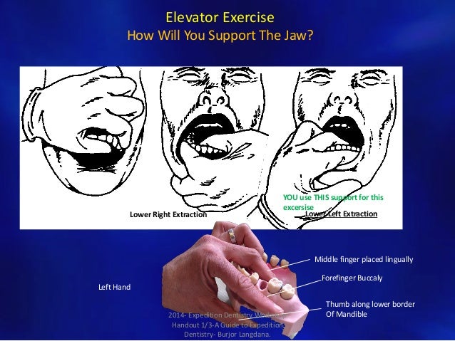 Expedition Dentistry Workshop Handout.