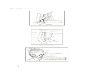 Experience of pelvic exenteration in king abdulazizi university ...