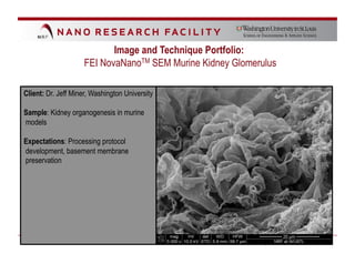 Image and Technique Portfolio:
                     FEI NovaNanoTM SEM Murine Kidney Glomerulus

Client: Dr. Jeff Miner, Washington University

Sample: Kidney organogenesis in murine
models

Expectations: Processing protocol
development, basement membrane
preservation
 