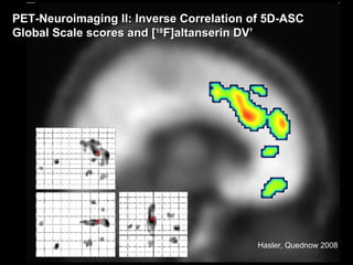 PET-Neuroimaging II:  Inverse Correlation of 5D-ASC  Global Scale scores and [ 18 F]altanserin DV’ Hasler, Quednow 2008 