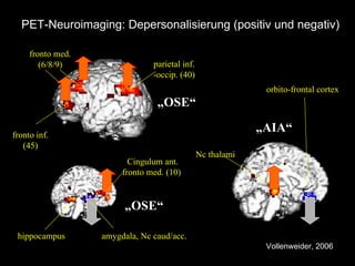 PET-Neuroimaging: Depersonalisierung (positiv und negativ) „ OSE“ hippocampus amygdala, Nc caud/acc. fronto med. (6/8/9) Cingulum ant. fronto med. (10)  parietal inf. -occip. (40) fronto inf. (45) Nc thalami  „ AIA“ orbito-frontal cortex  „ OSE“ Vollenweider, 2006 