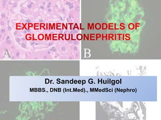 Dr. Sandeep G. Huilgol
MBBS., DNB (Int.Med)., MMedSci (Nephro)
 