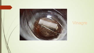 Vinagre
 