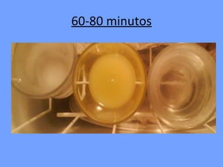 60-80 minutos 