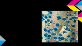 STEP 4
4- Break a tablet in half
and drop the half tablet
into the bottle. Watch it
sink to the bottom and
let the blobby greatness
begin!
 